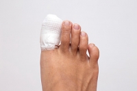 How to Care for a Broken Toe at Home