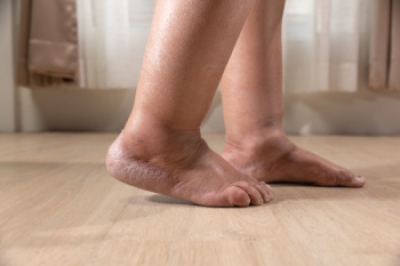How Edema Affects the Feet and Ankles